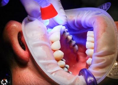 کمبود وقت باعث افزایش شدید خطای دندان پزشکان می گردد